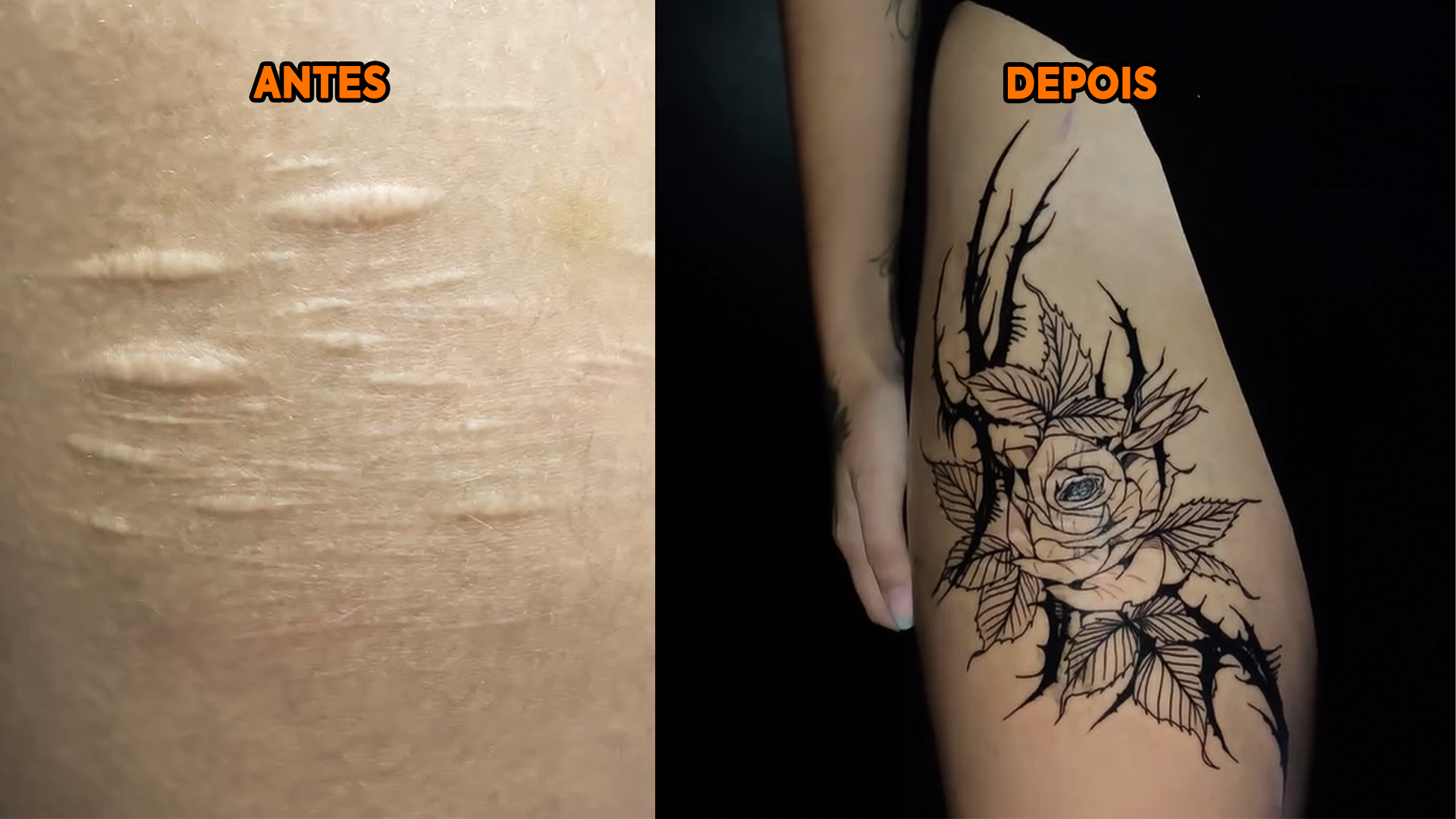Tatuadora de Uberlândia oferece 50% de desconto para cobrir cicatrizes de automutilação e gera debate nas redes